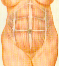 Placeholder Picture